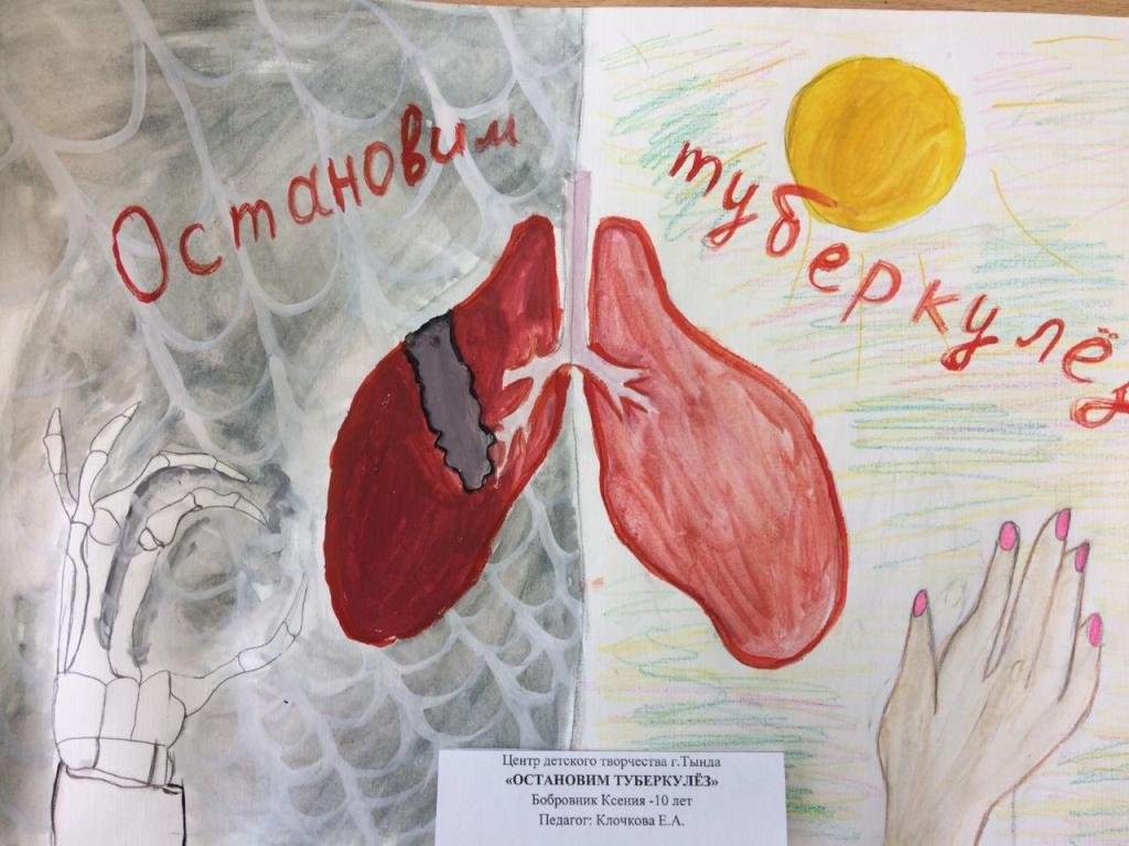 Конкурс туберкулез. Туберкулез рисунок. Картинки на тему туберкулез. Плакаты по борьбе с туберкулезом. Рисунок против туберкулеза.